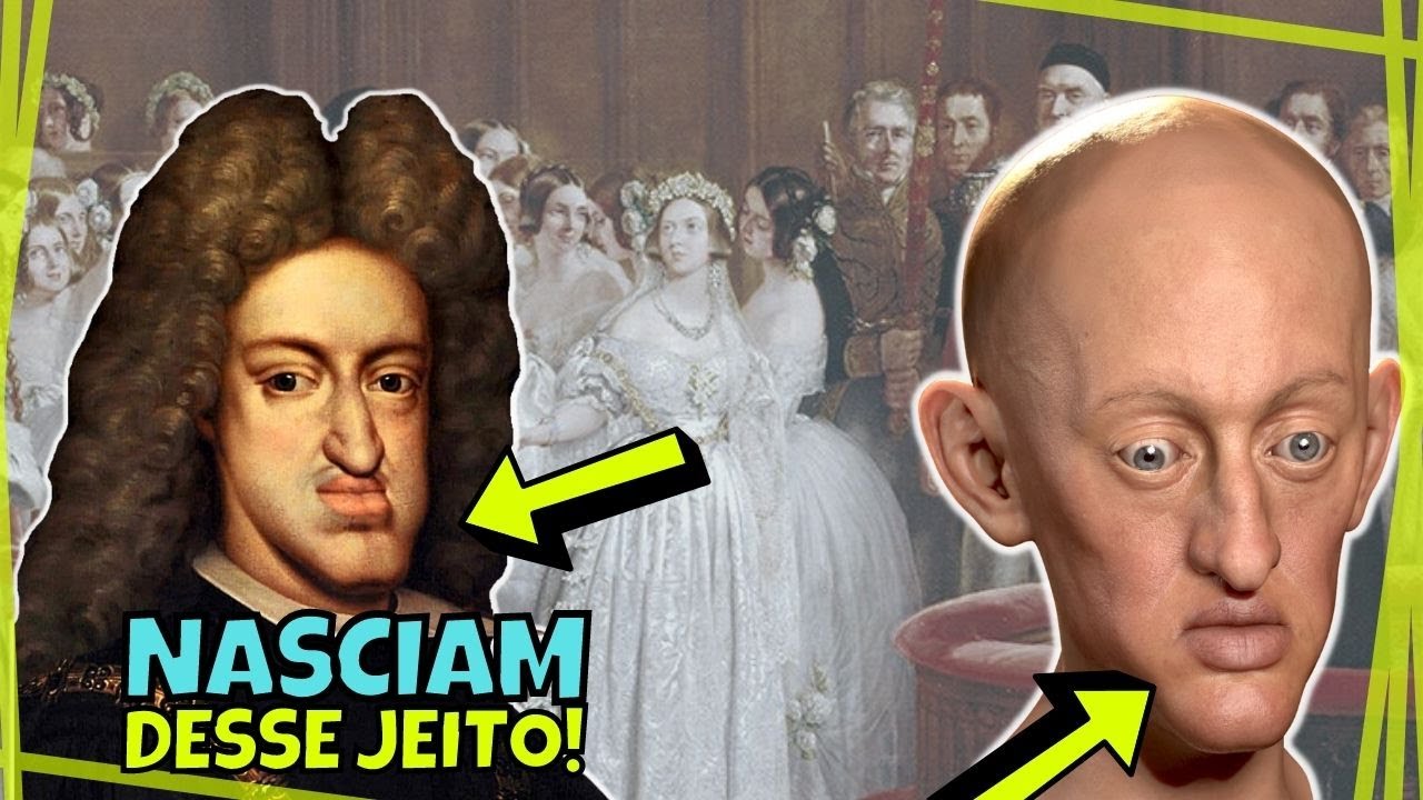Reescreva em Portugues do Brasil 👑 Perigos dos casamentos entre parentes e DOENÇAS HEREDITÁRIAS na história da realeza